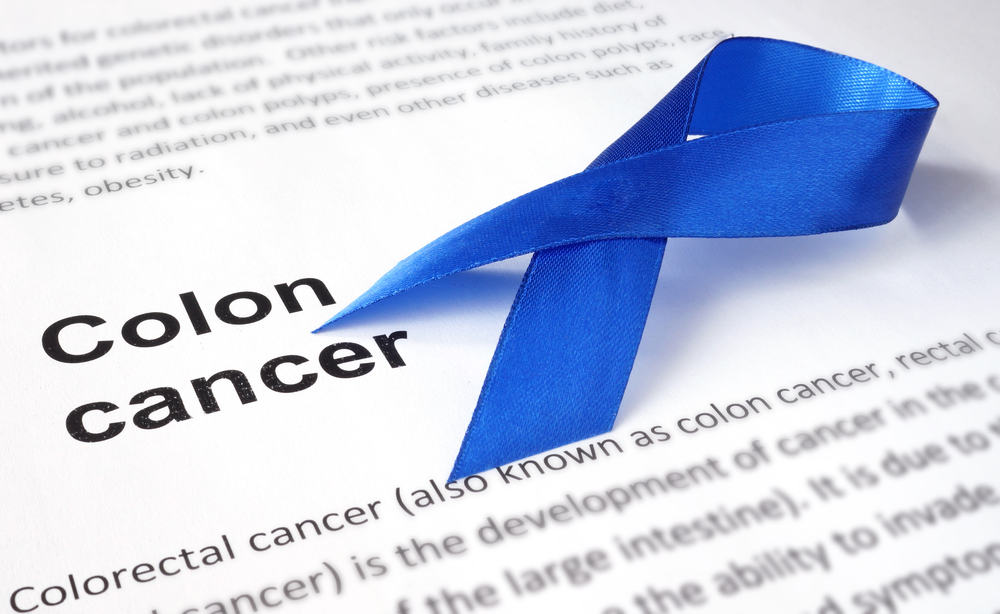 Colon Cancer